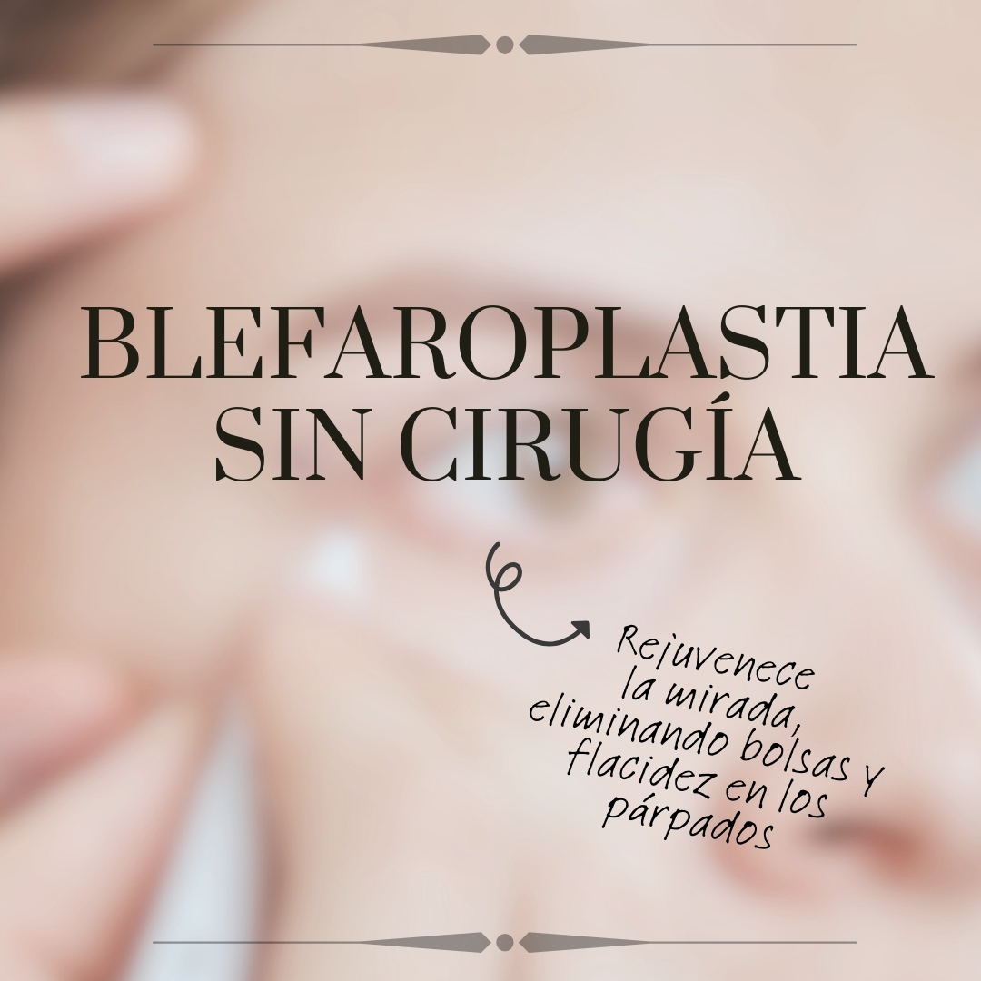 medicina-estetica-blefaroplastia-sin-cirugia